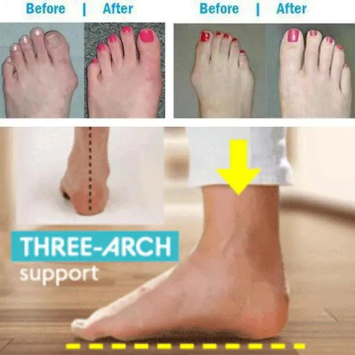 Orthopädische Zehenkorrektur-Sandalen von HappyU Health Sandals™